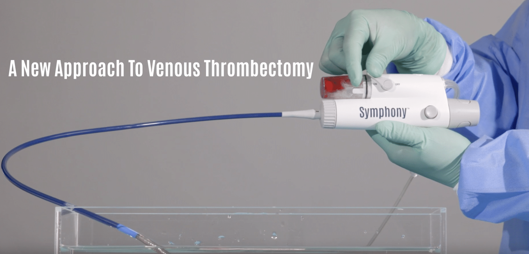 Imperative Care Expands Symphony Precision Thrombectomy Portfolio with Purpose-Built Design for the Treatment of Venous Thrombosis